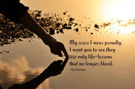 Life Lessons Like most of us there was pain, love and loss. Life-lessons aren’t free they come at a cost.. I am a bit wiser since the day of my birth. That’s all we can hope for on sweet Mother Earth.. My scars I wear proudly, I want you to see,they are only life-lessons that no longer bleed.. So smile through the tough times and laugh when you can.Love everyone that lives on this beautiful land.. ©April Peerless 2013
